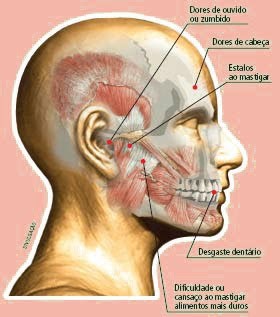 Orofacial Exemplo 1